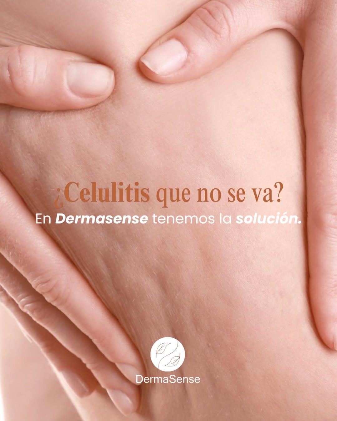 Publicación de DermaSense sobre tratamientos corporales