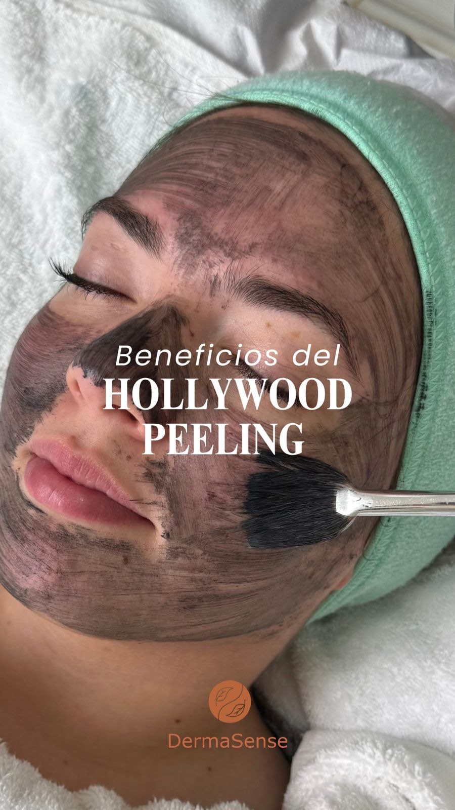 Publicación de DermaSense sobre Hollywood Peeling