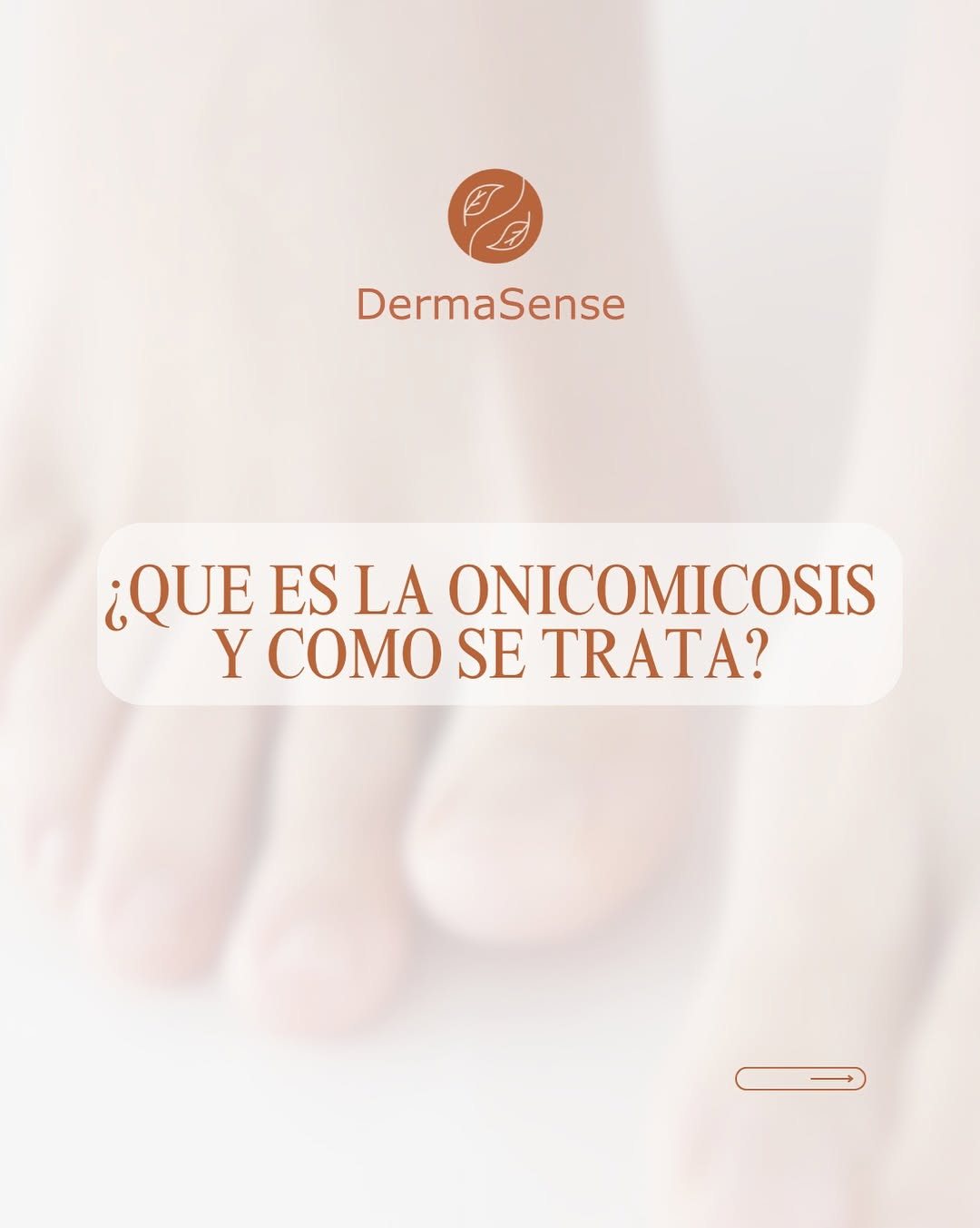 Publicación de DermaSense sobre cuidado de uñas
